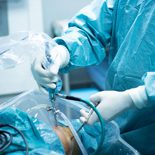 knee arthroscopy treatment